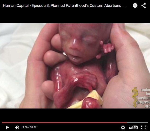  photo planned_parenthood_horror_zps6rsqfmww.jpg